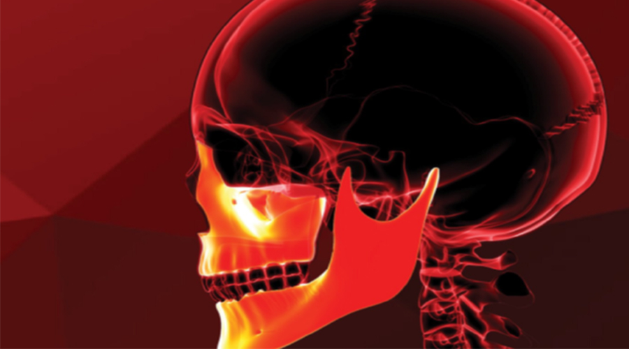 Singular让3D打印骨植入物接近现实，在得到Osteopore验证结果后或将实现