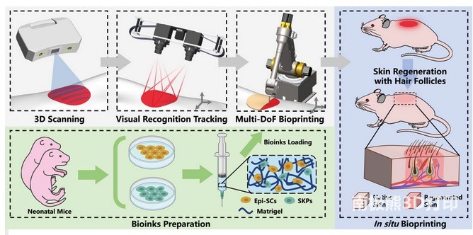 清华大学徐韬教授课题组：自适应多自由度原位皮肤打印